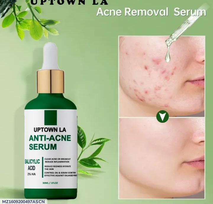 Anti-Acne Serum 30ML Green Glass Bottle
