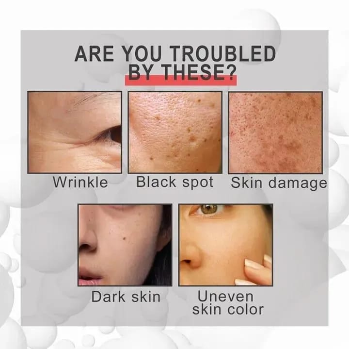 Retinol Serum for Acne Prone Skin Buy 1 Get 1 Free
