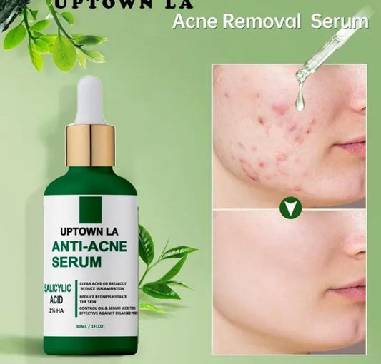 Anti-Acne Serum 30ML Green Glass Bottle